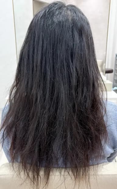 日野達也の施術前